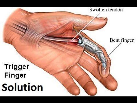 How to Improve your Trigger Finger!